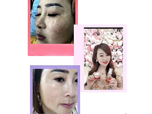 案例