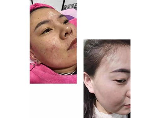 案例