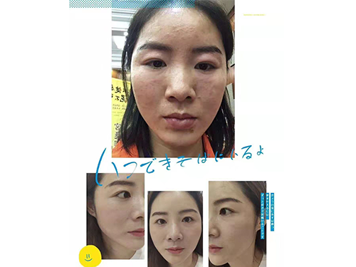 案例
