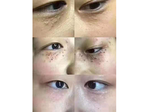 案例
